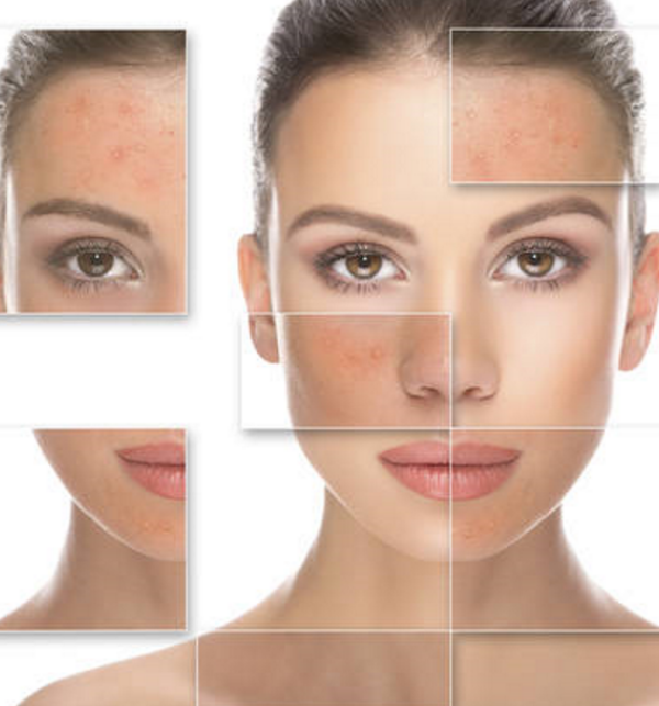 centro estetico hara spa wellness roma - trattamenti corpo roma